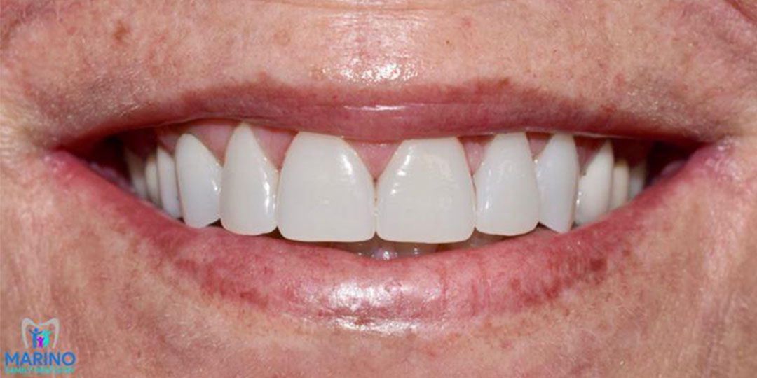 Greater Jacksonville Florida Smile Restorations