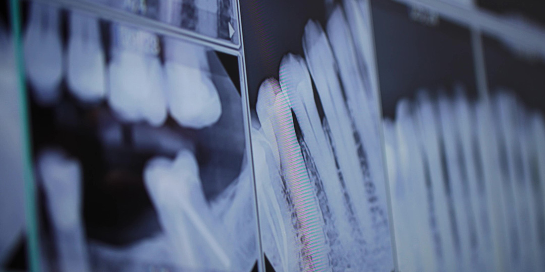 Dental Implant Dentists Greater Jacksonville Florida