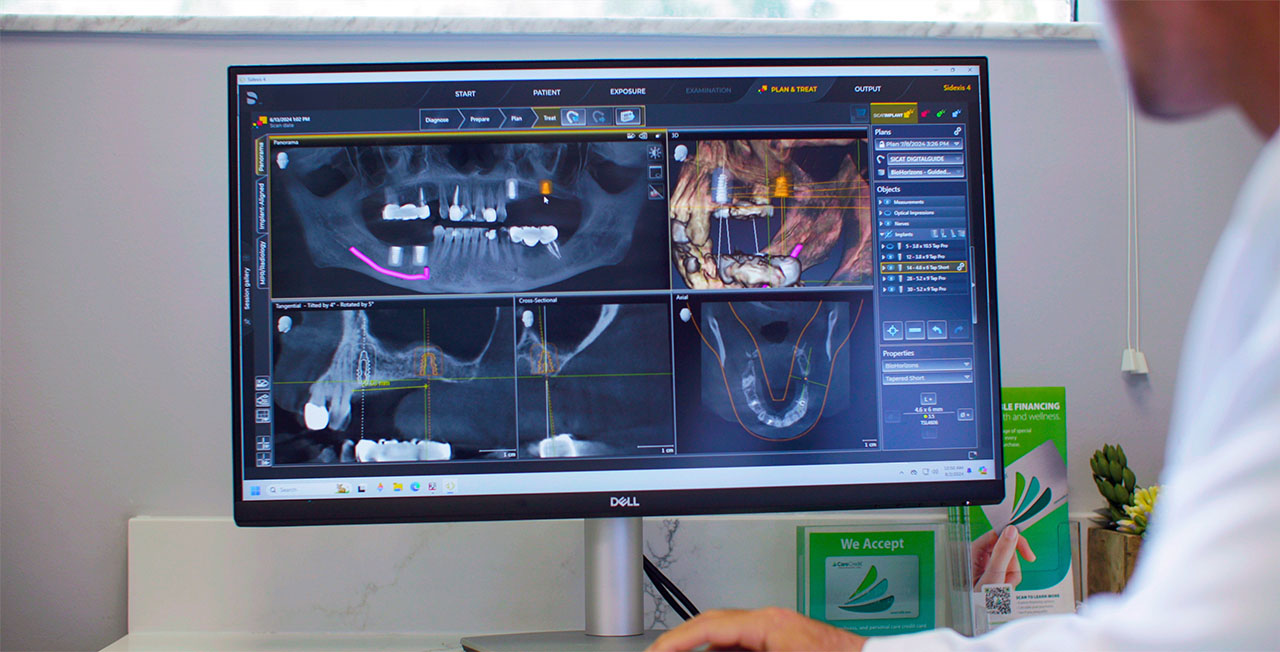 Tooth Extraction Dentist In Orange Park Fl