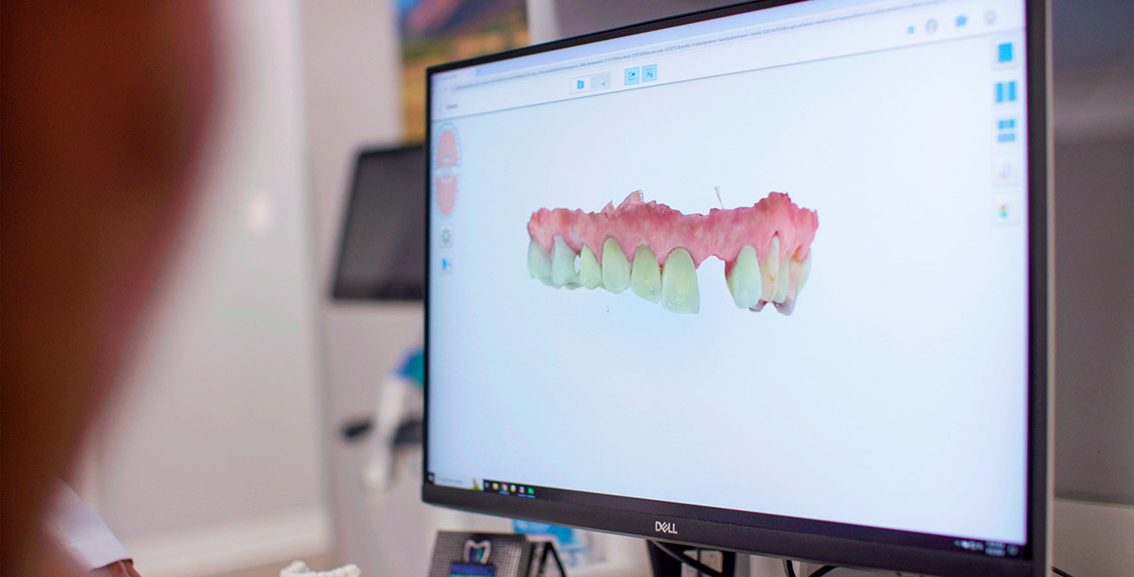 Dental Implant Dentist Orange Park Fl